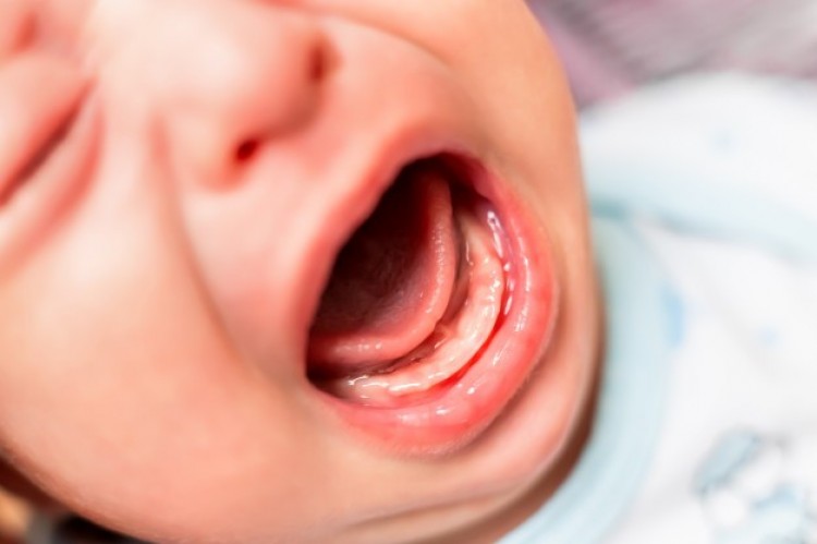 .:: teste_da_linguinha_em_bebes_voce_ja_ouviu_falar_41152_1_pt.jpg ::.